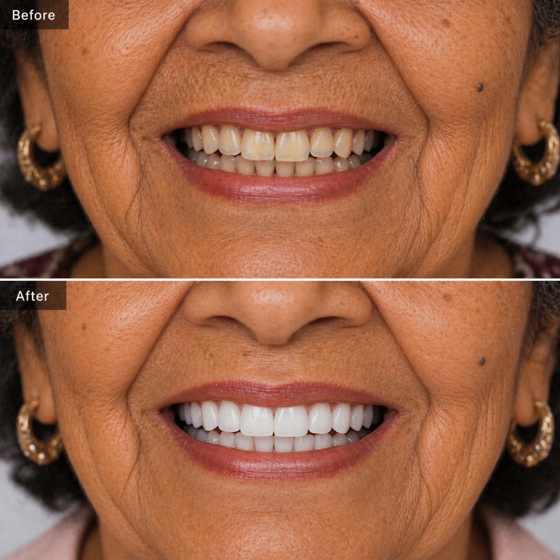 Before and after pediatric dentistry for La Palma patients